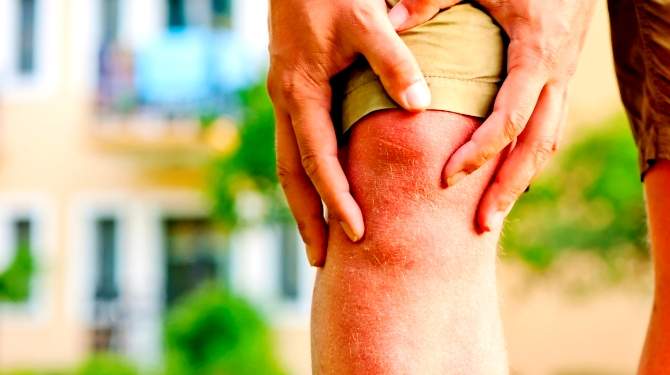 Natural ways to treat joint pain