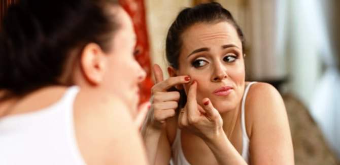 Natural ways of treating pimples