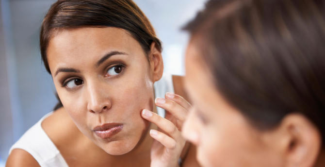 12 Home Remedies for Acne Scars