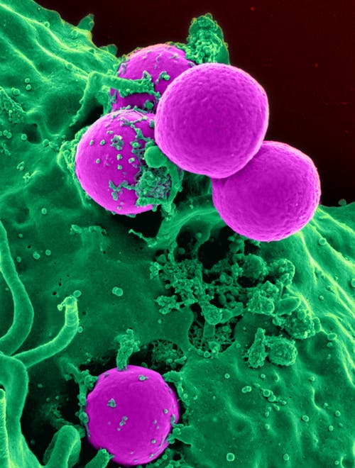 Everything You Need To Know About Antimicrobial Resistance