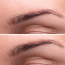 Everything You Need To Know About Brow Lift Treatment